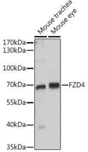 Western blot analysis of extracts of various cell lines, using Anti-Frizzled 4 Antibody (A16096) at 1:1,000 dilution