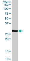 Anti-CDKN1B Goat Polyclonal Antibody