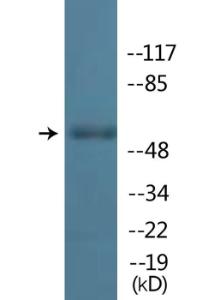 Western blot analysis of lysates from Jurkat cells using Anti-Lck (phospho Tyr192) Antibody