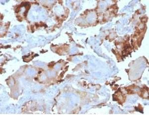 Anti-L-PLUNC Mouse Monoclonal Antibody [Clone: LPLUNC1/3206]