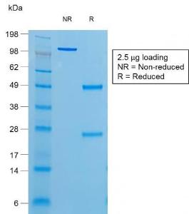 Anti-Thyroglobulin antibody