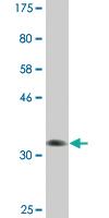 Anti-NFIC Mouse Monoclonal Antibody [clone: 1D6]