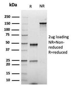 SDS-PAGE analysis of Anti-CD86 Antibody [rC86/6872] under non-reduced and reduced conditions; showing intact IgG and intact heavy and light chains, respectively. SDS-PAGE analysis confirms the integrity and purity of the antibody