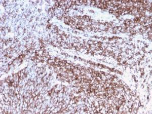 Anti-CD44 Mouse Recombinant Antibody [Clone: rHCAM/918]