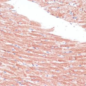 Immunohistochemistry analysis of paraffin-embedded mouse heart using Anti-Frizzled 4 Antibody (A16096) at a dilution of 1:100 (40X lens)