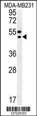 Anti-TRAM2 Rabbit Polyclonal Antibody