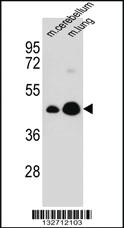 Anti-ITM2B Rabbit Polyclonal Antibody