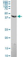 Anti-ADGRE4P Mouse Monoclonal Antibody [clone: 1G10]