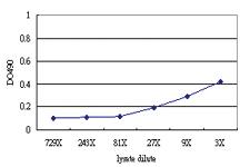 Anti-CDADC1 Antibody Pair