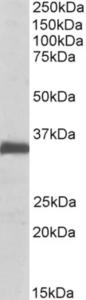 EB10239 (0.1 µg/ml) staining of Rat Lung lysate (35 µg protein in RIPA buffer). Primary incubation was 1 hour. Detected by chemiluminescence.