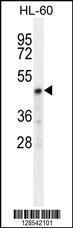 Anti-CHST2 Rabbit Polyclonal Antibody (PE (Phycoerythrin))