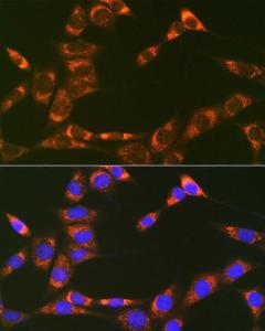 Immunofluorescence analysis of NIH-3T3 cells using Anti-REA Antibody [ARC1449] (A308350) at a dilution of 1:100 (40x lens). DAPI was used to stain the cell nuclei (blue).