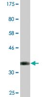 Anti-STK38 Mouse Monoclonal Antibody [clone: 2F6]