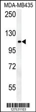 Anti-OTUD4 Rabbit Polyclonal Antibody