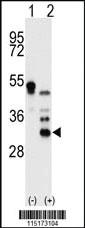 Anti-OR1N1 Rabbit Polyclonal Antibody