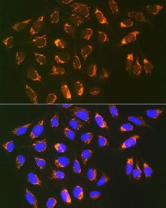 Immunofluorescence analysis of U-2 OS cells using Anti-REA Antibody [ARC1449] (A308350) at a dilution of 1:100 (40x lens). DAPI was used to stain the cell nuclei (blue).