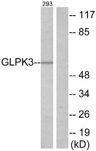 Western blot analysis of lysates from 293 cells using Anti-GK3 Antibody. The right hand lane represents a negative control, where the antibody is blocked by the immunising peptide