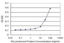 Anti-AFF4 Polyclonal Antibody Pair