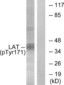 Western blot analysis of lysates from Jurkat cells treated with UV 15' using Anti-LAT (phospho Tyr171) Antibody. The right hand lane represents a negative control, where the antibody is blocked by the immunising peptide.