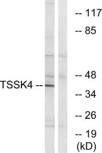 Western blot analysis of lysates from HT-29 cells using Anti-TSSK4 Antibody. The right hand lane represents a negative control, where the Antibody is blocked by the immunising peptide