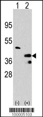 Anti-PRMT1 Rabbit Polyclonal Antibody