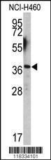 Anti-EN2, CT-2 Rabbit Polyclonal Antibody (HRP (Horseradish Peroxidase))