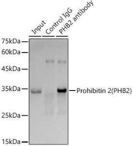 Immunoprecipitation analysis of 300µg extracts of SKOV3 cells using 3µg of Anti-REA Antibody [ARC1449] (A308350). This Western blot was performed on the immunoprecipitate using Anti-REA Antibody [ARC1449] (A308350) at a dilution of 1:1000.