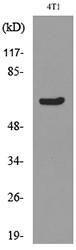 Western blot analysis of lysate from 4T1 cells using Anti-Ku70 (acetyl Lys331) Antibody