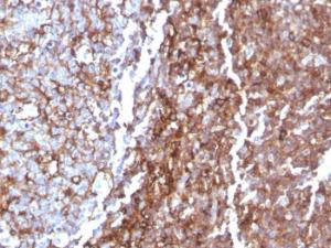 Anti-CD44 Mouse Recombinant Antibody [Clone: rHCAM/918]