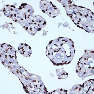 Immunohistochemistry analysis of paraffin-embedded human placenta using Anti-ILF3 Antibody [ARC1438] (A16105) at a dilution of 1:100 (40X lens). Perform microwave antigen retrieval with 10 mM Tris/EDTA buffer pH 9.0 before commencing with IHC staining protocol