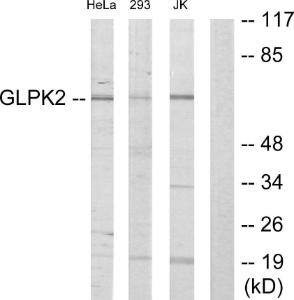 Western blot analysis of lysates from HeLa, 293, and Jurkat cells using Anti-GK2 Antibody. The right hand lane represents a negative control, where the Antibody is blocked by the immunising peptide