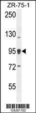 Anti-ACAP1 Rabbit Polyclonal Antibody (AP (Alkaline Phosphatase))