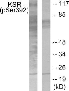 Western blot analysis of lysates from HepG2 cells using Anti-KSR (phospho Ser392) Antibody The right hand lane represents a negative control, where the antibody is blocked by the immunising peptide