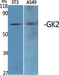 Western blot analysis of various cells using Anti-GK2 Antibody