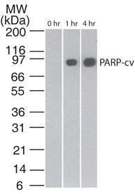 NOVUNBP2-25080 - APOPTOSIS DETECTION ANTIBODY PACK