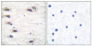 Immunohistochemical analysis of paraffin-embedded human brain using Anti-KSR (phospho Ser392) Antibody The right hand panel represents a negative control, where the antibody was pre-incubated with the immunising peptide