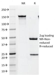 SDS-PAGE analysis of Anti-HER2 Antibody [HRB2/451] under non-reduced and reduced conditions; showing intact IgG and intact heavy and light chains, respectively. SDS-PAGE analysis confirms the integrity and purity of the antibody