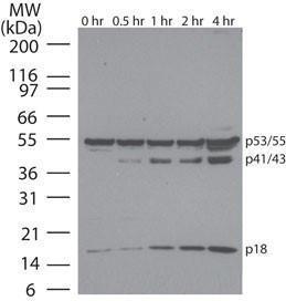 NOVUNBP2-25080 - APOPTOSIS DETECTION ANTIBODY PACK