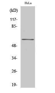 Western blot analysis of Jurkat cells using Anti-GK2 Antibody