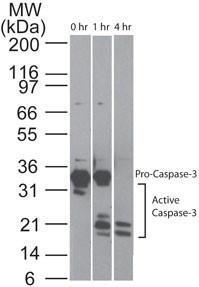 NOVUNBP2-25080 - APOPTOSIS DETECTION ANTIBODY PACK