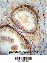 Anti-NUDT8 Rabbit Polyclonal Antibody (Biotin)