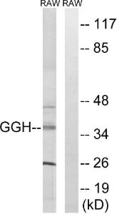 Western blot analysis of lysates from RAW264.7 cells using Anti-GGH Antibody. The right hand lane represents a negative control, where the Antibody is blocked by the immunising peptide