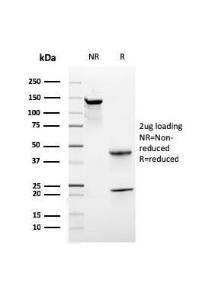 Anti-CD44 Mouse Recombinant Antibody [Clone: rHCAM/918]