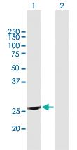 Anti-RAB37 Mouse Polyclonal Antibody