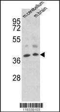 Anti-EN2 Rabbit Polyclonal Antibody (FITC (Fluorescein))