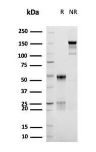 SDS-PAGE analysis of Anti-CD30 Antibody [rKi-1/6913] under non-reduced and reduced conditions; showing intact IgG and intact heavy and light chains, respectively. SDS-PAGE analysis confirms the integrity and purity of the antibody