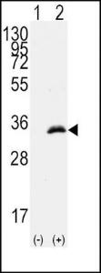 Anti-CDK1 Rabbit Polyclonal Antibody (Biotin)