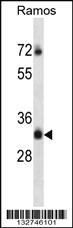 Anti-TMEM55B Rabbit Polyclonal Antibody