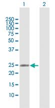 Anti-RAB37 Rabbit Polyclonal Antibody