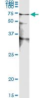 Anti-STK38 Antibody Pair